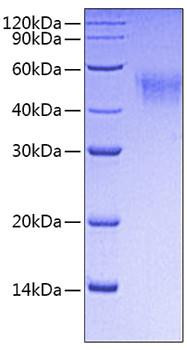 Recombinant Mouse Fc gamma RI/FCGR1/CD64 Protein (RPCB0717)