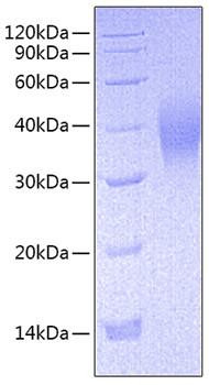 Recombinant Mouse Fc-gamma RIII/CD16 Protein (RPCB0744)