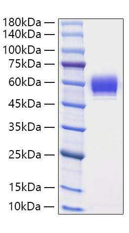 Recombinant Human Serpin B3/SCCA-1 Protein (RPCB0777)
