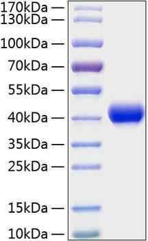 Recombinant Mouse CXCL16/SR-PSOX Protein (RPCB0769)