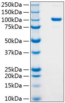 Recombinant Human Argonaute-2/AGO2 Protein (RPCB0825)