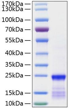 Recombinant Human GTPase KRas/KRAS(G12V) Protein (RPCB0830)