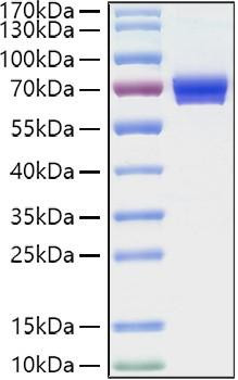 Recombinant Human IL-2RA/CD25 Protein (RPCB0910)