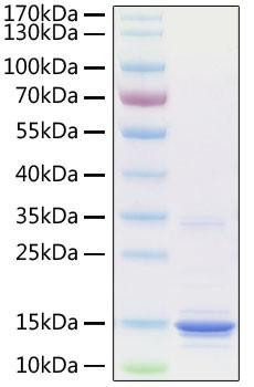 Recombinant Human S100-A9 Protein (RPCB0914)
