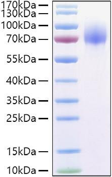 Recombinant Human Osteoactivin/GPNMB Protein (RPCB0917)
