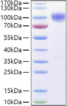 Recombinant Human TNFRSF21/DR6/CD358 Protein (RPCB0949)