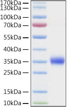 Recombinant Human TIMP-1 Protein (RPCB0960)