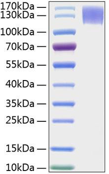 Recombinant Human MERTK Protein (RPCB1008)