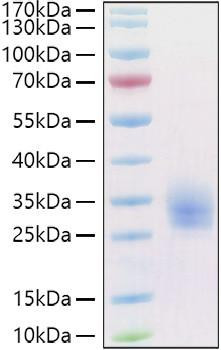 Recombinant Human LAIR-1/CD305 Protein (RPCB1023)