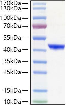Recombinant Human YKL-40/CHI3L1 Protein (RPCB1114)