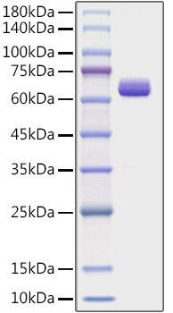 Recombinant Human Collagen I alpha 2/COL1A2 Protein (RPCB1132)