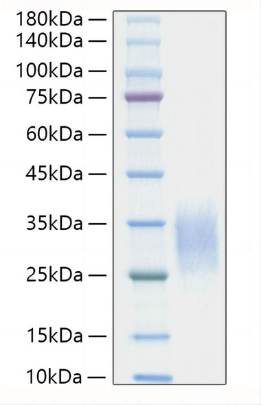 Recombinant Mouse IL-19 Protein (RPCB1137)