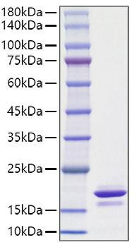Recombinant Human Alpha-synuclein/SNCA Protein (RPCB1155)