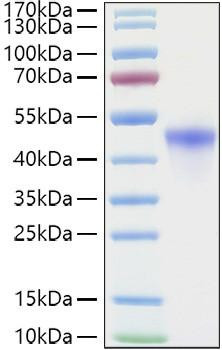 Recombinant Human VSIG4 Protein (RPCB1151)