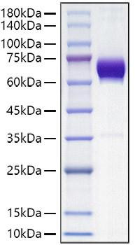 Recombinant Mouse B7-DC/PD-L2/CD273 Protein (RPCB1167)