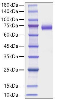 Recombinant Mouse DLL4 Protein (RPCB1180)