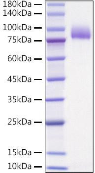 Recombinant Human IL-1 Rrp2/IL-1 R6 Protein (RPCB1265)