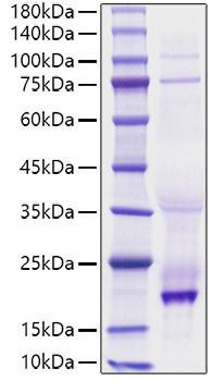 Recombinant Human TNFSF13B/BAFF/CD257 Protein (RPCB1340)