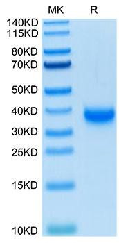 Biotinylated Recombinant SARS-COV-2 Spike RBD  Protein (RPCB1350)