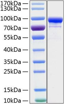 Recombinant Human STAT1 Protein (RPCB1354)