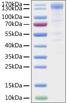 Recombinant SARS-CoV-2 Spike S1 Protein (RPCB1355)