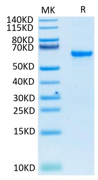 Recombinant SARS-COV-2 Spike RBD  Protein (RPCB1386)