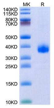 Recombinant SARS-CoV-2 Spike RBD(B.1.640.2/IHU) Protein (RPCB1383)