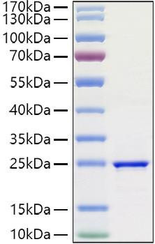 Recombinant Human FGF-3 Protein (RPCB1416)