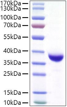 Recombinant SARS-CoV-2 Spike RBD(Lambda/C.37)  Protein (RPCB1442)