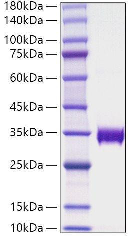 Recombinant Human AMBP Protein (RPCB1657)