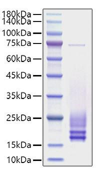 Recombinant Rat Cystatin-C/CST3 Protein (RPCB1731)