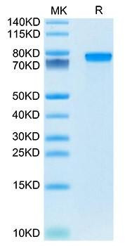 Recombinant Mouse Progranulin/PGRN/GRN Protein (RPCB1838)