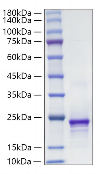 Recombinant Mouse FGF-10 Protein (RPCB1866)