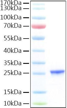 Recombinant Human CGB7 Protein (RPCB1889)