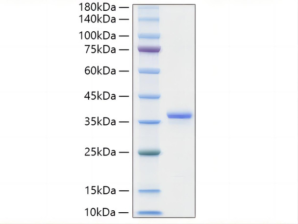 Recombinant Mouse IGFBP-2 Protein (RPCB1927)