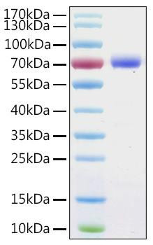 Recombinant Human Annexin A6/ANXA6 Protein (RPCB1976)