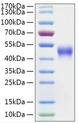 Recombinant Mouse IL-2 R beta/CD122 Protein (RPCB1978)