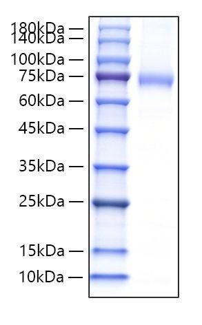 Recombinant Mouse Endoglin/ENG/CD105 Protein (RPCB2014)