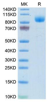 Recombinant Mouse Interferon alpha/beta receptor 1/IFNAR1 Protein (RPCB2090)