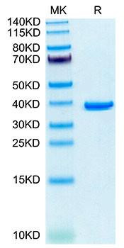 Recombinant Human Annexin A2/ANXA2 Protein (RPCB2104)