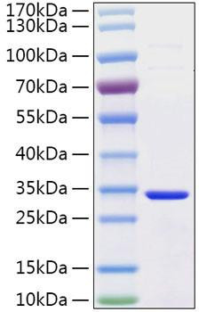 Recombinant Human Secretagogin/SCGN Protein (RPCB2114)