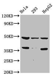 SOX4 Antibody (PACO65157)
