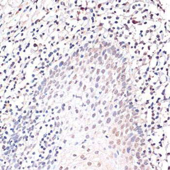 Anti-c-Jun Antibody (CAB11378)