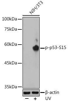 Anti-Phospho-p53-S15 Antibody (CABP0083)
