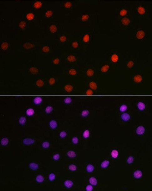 Anti-Acetyl-HMGB1-K29 Antibody -Knockout Validated (CAB16002)