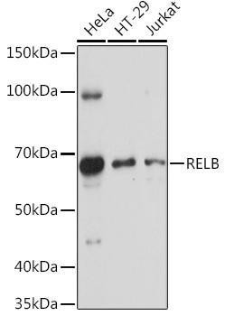 Anti-RELB Antibody (CAB0519)
