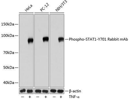 Anti-Phospho-STAT1-Y701 [ARC0049] Monoclonal Antibody (CABP0054)