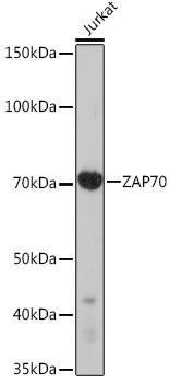 Anti-ZAP70 [ARC51229] Monoclonal Antibody (CAB9536)