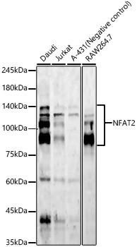 Anti-NFAT2 [ARC57041] Monoclonal Antibody (CAB23485)