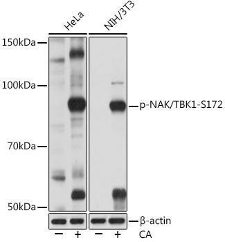 Anti-Phospho-TBK1/NAK-S172 [ARC1571] Monoclonal Antibody (CABP1026)